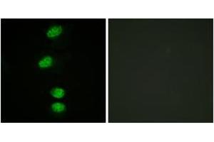 Immunofluorescence analysis of HeLa cells, using Androgen Receptor (Phospho-Ser94) Antibody. (Androgen Receptor anticorps  (pSer94))