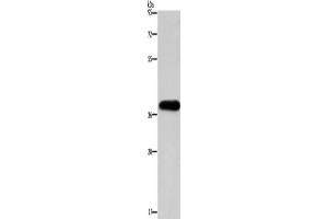 Western Blotting (WB) image for anti-Paired-Like Homeodomain 2 (PITX2) antibody (ABIN2422772) (PITX2 anticorps)