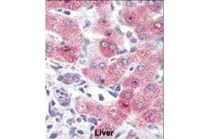 Immunohistochemistry (Paraffin-embedded Sections) (IHC (p)) image for anti-Synovial Apoptosis Inhibitor 1, Synoviolin (SYVN1) (AA 586-617), (C-Term) antibody (ABIN388980)