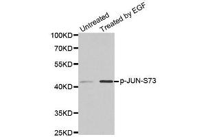 Western blot analysis of extracts from PC14 cells using phospho-JUN-S73 antibody (ABIN2987353). (C-JUN anticorps  (pSer73))
