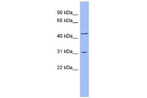 WB Suggested Anti-DHODH Antibody Titration:  0. (DHODH anticorps  (N-Term))