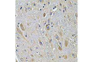 Immunohistochemistry of paraffin-embedded rat brain using PLCG1 Antibody. (Phospholipase C gamma 1 anticorps)