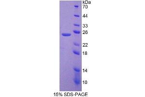 SDS-PAGE (SDS) image for Gelsolin (GSN) (AA 432-625) protein (His tag) (ABIN2124946) (Gelsolin Protein (GSN) (AA 432-625) (His tag))