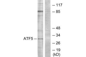 Western blot analysis of extracts from Jurkat cells, using ATF5 antibody. (ATF5 anticorps  (C-Term))