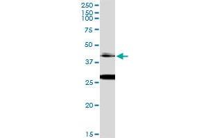 Immunoprecipitation of OTX1 transfected lysate using anti-OTX1 MaxPab rabbit polyclonal antibody and Protein A Magnetic Bead , and immunoblotted with OTX1 monoclonal antibody (M01), clone 1F2 . (OTX1 anticorps  (AA 1-354))