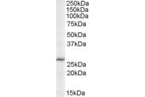 Image no. 1 for anti-Acidic (Leucine-Rich) Nuclear phosphoprotein 32 Family, Member B (ANP32B) (C-Term) antibody (ABIN374313) (ANP32B anticorps  (C-Term))