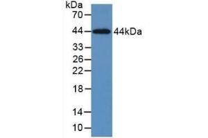 Detection of Recombinant KRT5, Human using Monoclonal Antibody to Cytokeratin 5 (CK5) (Cytokeratin 5 anticorps  (AA 168-481))