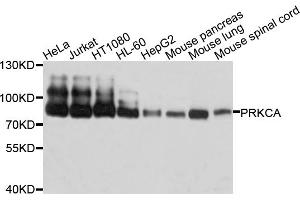 Western blot analysis of extracts of various cell lines, using PRKCA antibody. (PKC alpha anticorps)