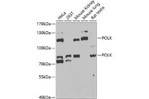 Western blot analysis of extracts of various cell lines, using POLK antibody (ABIN6128477, ABIN6145899, ABIN6145903 and ABIN6221718) at 1:1000 dilution. (POLK anticorps  (AA 1-260))