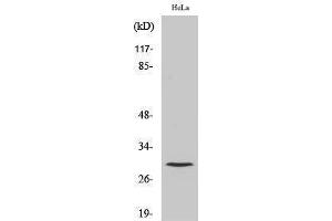 Western Blotting (WB) image for anti-Cathepsin L1 (CTSL1) (Cleaved-Thr288), (Heavy Chain) antibody (ABIN6286678) (Cathepsin L anticorps  (Cleaved-Thr288, Heavy Chain))