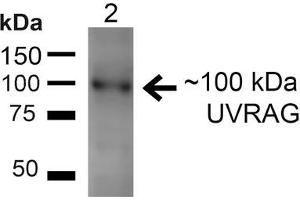 Western blot analysis of Rat Liver showing detection of ~100kDa UVRAG protein using Rabbit Anti-UVRAG Polyclonal Antibody . (UVRAG anticorps  (Biotin))