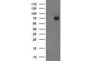 HEK293T cells were transfected with the pCMV6-ENTRY control (Left lane) or pCMV6-ENTRY SH2B3 (Right lane) cDNA for 48 hrs and lysed. (SH2B3 anticorps)