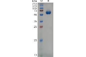 Mouse CS1 Protein, hFc Tag on SDS-PAGE under reducing condition. (Catalase Protein (CAT) (AA 23-224) (Fc Tag))