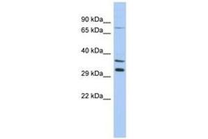 Image no. 1 for anti-Testis Specific, 13 (TSGA13) (C-Term) antibody (ABIN6743646) (TSGA13 anticorps  (C-Term))