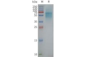 Elisa plates were pre-coated with Flag Tag PR-Nanodisc (0. (Prokineticin Receptor 1 Protein (PROKR1))
