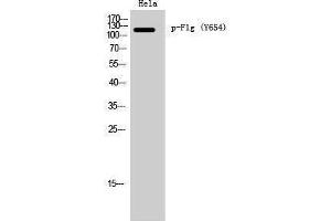 Western Blotting (WB) image for anti-Filaggrin (FLG) (pTyr654) antibody (ABIN3173166) (Filaggrin anticorps  (pTyr654))