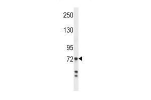 Western blot analysis in MDA-MB231 cell line lysates (35ug/lane). (Myeloperoxidase anticorps  (AA 420-448))