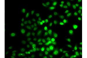 Immunofluorescence analysis of A549 cell using PRDM7 antibody. (PRDM7 anticorps)