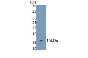 Detection of Recombinant KRT2, Human using Monoclonal Antibody to Keratin 2 (CK2) (Keratin 2 anticorps  (AA 7-160))