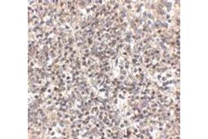 Immunohistochemistry (IHC) image for anti-R-Spondin 1 (RSPO1) (N-Term) antibody (ABIN1031546) (RSPO1 anticorps  (N-Term))