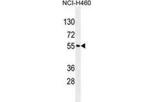 Western blot analysis in NCI-H460 cell line lysates (35ug/lane) using MIER2 Antibody (N-term). (MIER2 anticorps  (N-Term))
