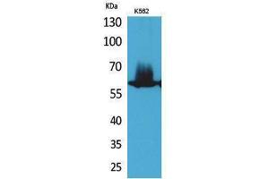 Western Blotting (WB) image for anti-Nuclear Factor-kB p65 (NFkBP65) (Thr743) antibody (ABIN3187851) (NF-kB p65 anticorps  (Thr743))