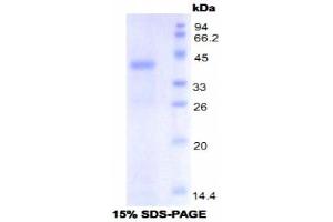 SDS-PAGE analysis of Mouse Toll Like Receptor 4 Protein. (TLR4 Protéine)