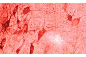 Immunohistochemistry analysis using Rabbit Anti-HO-1 Polyclonal Antibody . (HMOX1 anticorps  (APC))