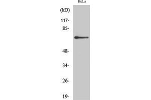 Western Blot analysis of HeLa cells using AR-β2 Polyclonal Antibody diluted at 1:2000. (Androgen Receptor beta 2 anticorps  (AA 180-260))