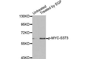 Western Blotting (WB) image for anti-Myc Proto-Oncogene protein (MYC) (pSer373) antibody (ABIN1870452) (c-MYC anticorps  (pSer373))
