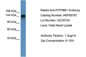 WB Suggested Anti-PITPNM1  Antibody Titration: 0. (PITPNM1 anticorps  (N-Term))