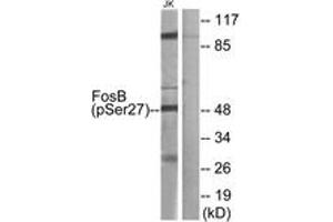 Western Blotting (WB) image for anti-FBJ Murine Osteosarcoma Viral Oncogene Homolog B (FOSB) (AA 12-61), (pSer27) antibody (ABIN482211) (FOSB anticorps  (pSer27))