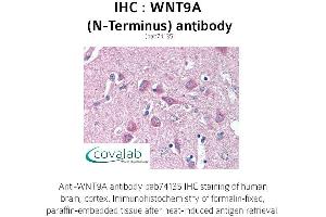 Image no. 1 for anti-Wingless-Type MMTV Integration Site Family, Member 9A (WNT9A) (N-Term) antibody (ABIN1740844) (WNT9A anticorps  (N-Term))