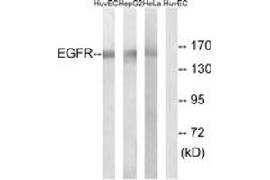 Western blot analysis of extracts from HuvEc/HepG2/HeLa cells, using EGFR (Ab-1071) Antibody. (EGFR anticorps  (AA 1036-1085))
