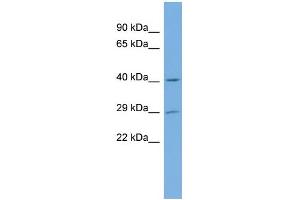 WB Suggested Anti-NAT15 Antibody Titration:  0. (NAT15 anticorps  (Middle Region))