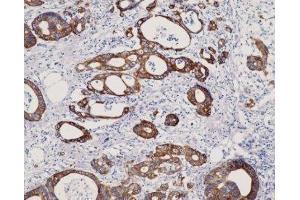 Immunohistochemistry (IHC) image for anti-Keratin 8 (KRT8) (C-Term) antibody (ABIN870549) (KRT8 anticorps  (C-Term))