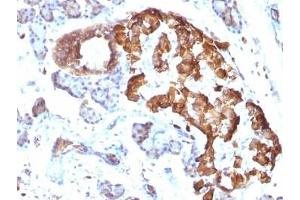 Immunohistochemistry (Formalin-fixed Paraffin-embedded Sections) (IHC (fp)) image for anti-Tumor Necrosis Factor alpha (TNF alpha) antibody (ABIN3023860)