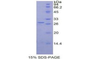 SDS-PAGE (SDS) image for Glucose-6-Phosphate Isomerase (GPI) (AA 263-475) protein (His tag) (ABIN1878115) (GPI Protein (AA 263-475) (His tag))