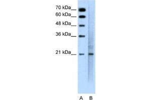 Western Blotting (WB) image for anti-Mucin 1 (MUC1) antibody (ABIN2462410) (MUC1 anticorps)