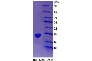 SDS-PAGE analysis of Human PTPMT1 Protein. (PTPMT1 Protéine)