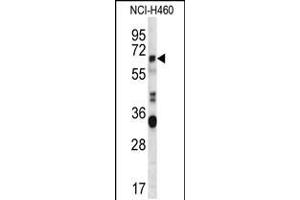 Western blot analysis in NCI-H460 cell line lysates (35ug/lane). (HERV-FRD Provirus Ancestral Env Polyprotein (Herv-frd) (AA 79-107), (N-Term) anticorps)