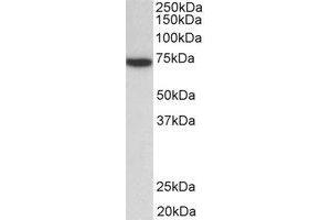 Western Blotting (WB) image for anti-zeta-Chain (TCR) Associated Protein Kinase 70kDa (ZAP70) (Internal Region) antibody (ABIN2465058) (ZAP70 anticorps  (Internal Region))