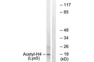 Western blot analysis of extracts from COS7 cells, treated with TSA 400nM 24h, using Histone H4 (Acetyl-Lys5) Antibody. (Histone H4 anticorps  (acLys5))