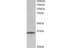 Western Blotting (WB) image for anti-Glyceraldehyde-3-Phosphate Dehydrogenase (GAPDH) (C-Term) antibody (ABIN185240)