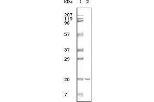 Western blot analysis using CD19 mouse mAb against CD19 recombinant protein. (CD19 anticorps)