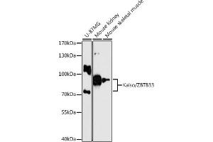 Western blot analysis of extracts of various cell lines, using Kaiso/Kaiso/ZBTB33 antibody  at 1:3000 dilution. (ZBTB33 anticorps  (AA 523-672))