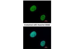 Immunofluorescence (IF) image for anti-GLI Family Zinc Finger 3 (GLI3) antibody (ABIN2855813)