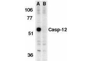 Western blot analysis of Caspase-12 in mouse brain tissue lysate in the absence (A) or presence (B) of blocking peptide with Caspase-12 antibody at 1μg/ml. (Caspase 12 anticorps  (AA 100-116))