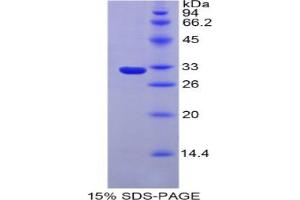 SDS-PAGE analysis of Mouse Iduronate-2-Sulfatase Protein. (IDS Protéine)