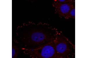 Immunofluorescence staining of methanol-fixed HeLa cells using FAK (phospho-Tyr576/Tyr577) Antibody (E011545, Red) (FAK anticorps  (pTyr576, pTyr577))